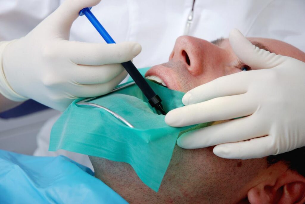 Root Canal Basics for Manhattan Patients