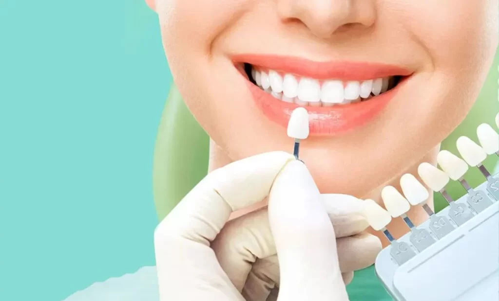 Home Teeth Whitening System to Help Amplify Your Smile