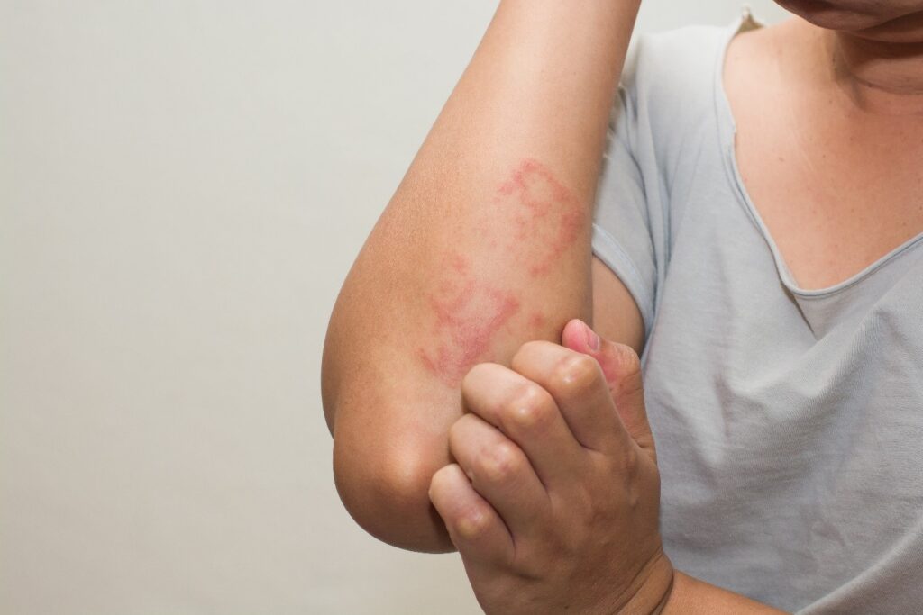Understanding the role of an Allergist in managing allergies