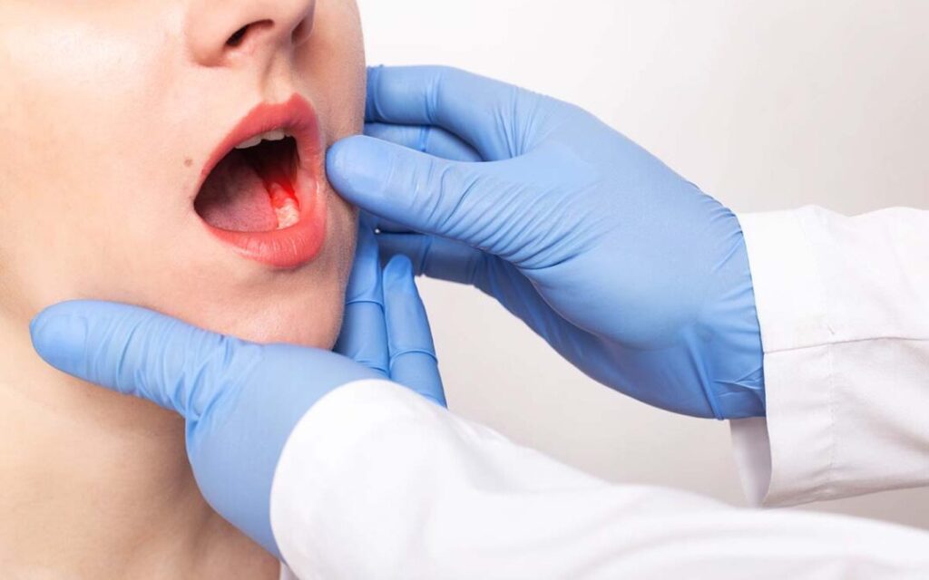 Preventing Gum Disease: Tips for Healthy Gums