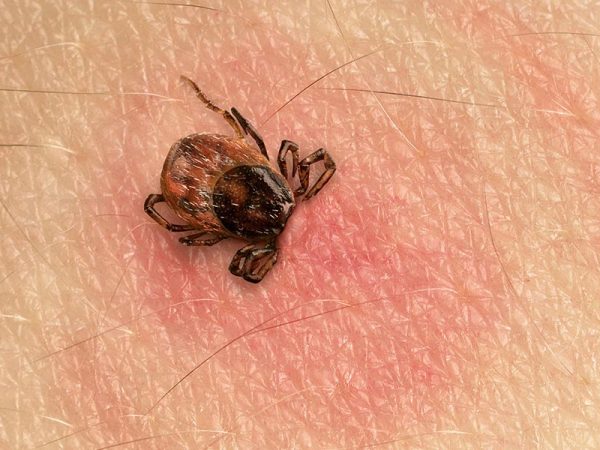 Lyme Lingers