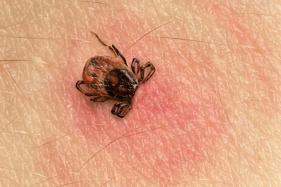 Lyme Lingers