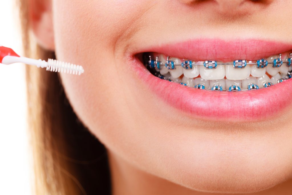 The Benefits of Using TT White Dental Zirconia Blocks in Restorations
